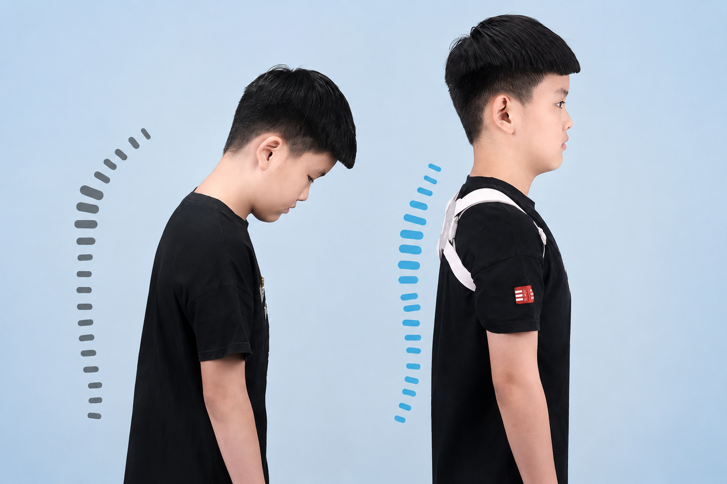 Skelefix Smart posture corrector